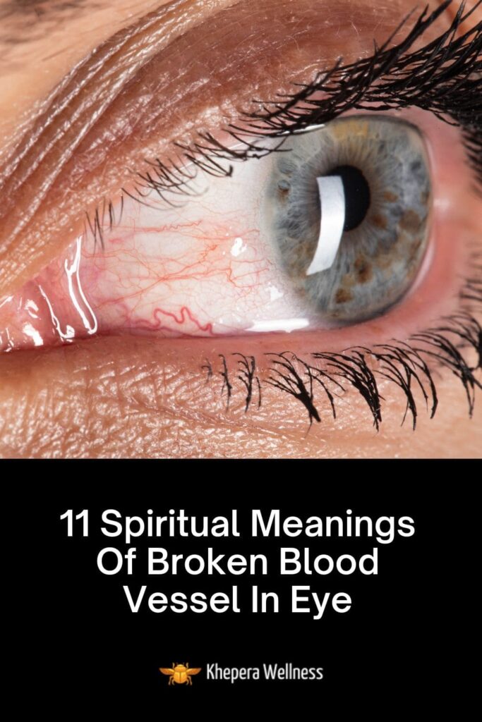 red eye spiritual meaning