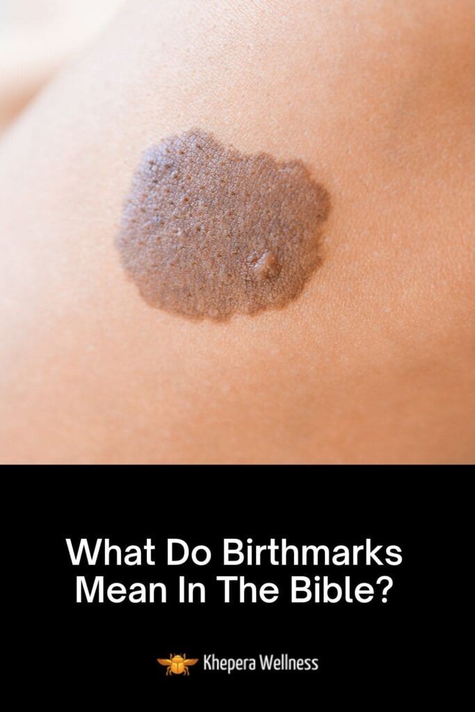 What Do Birthmarks Mean In The Bible