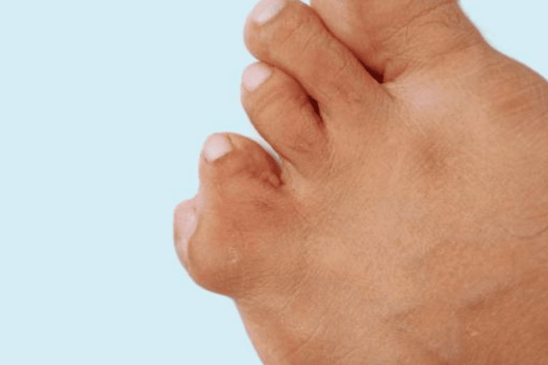 Webbed Toes: 11 Spiritual Meanings You Should Know