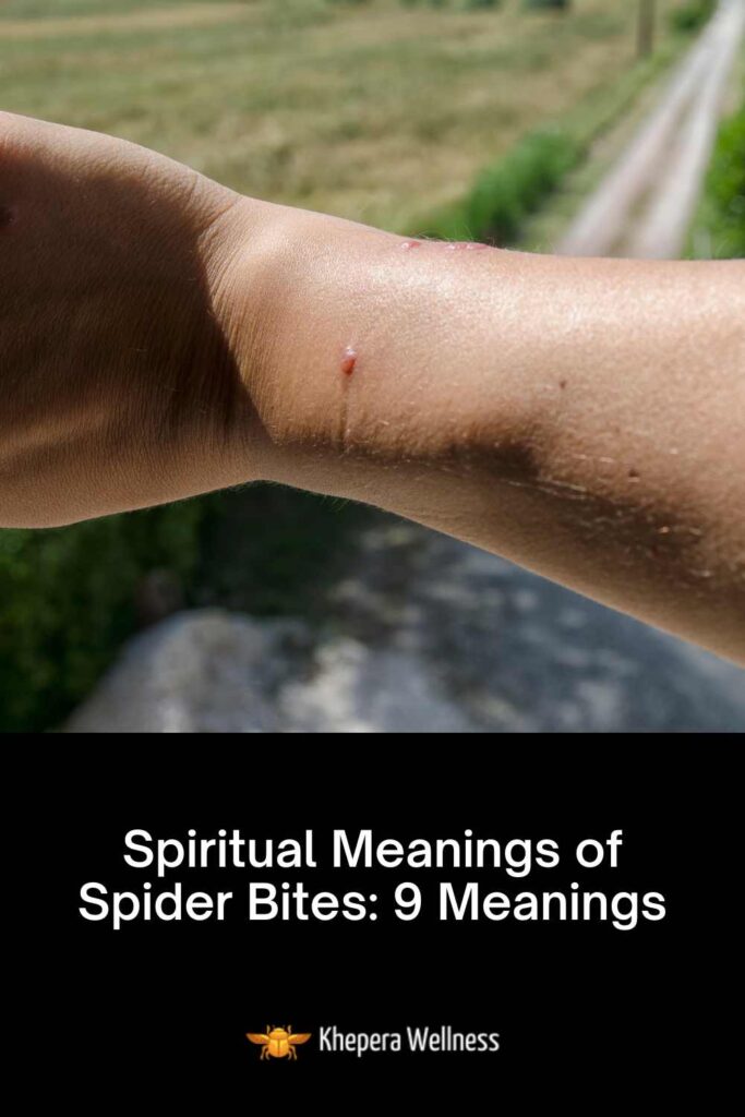 Spiritual Meanings of Spider Bites 9 Meanings