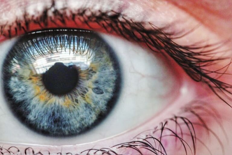 Blue Ring Around Iris Spiritual Meaning: 8 Warnings