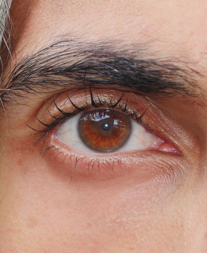 Golden eye